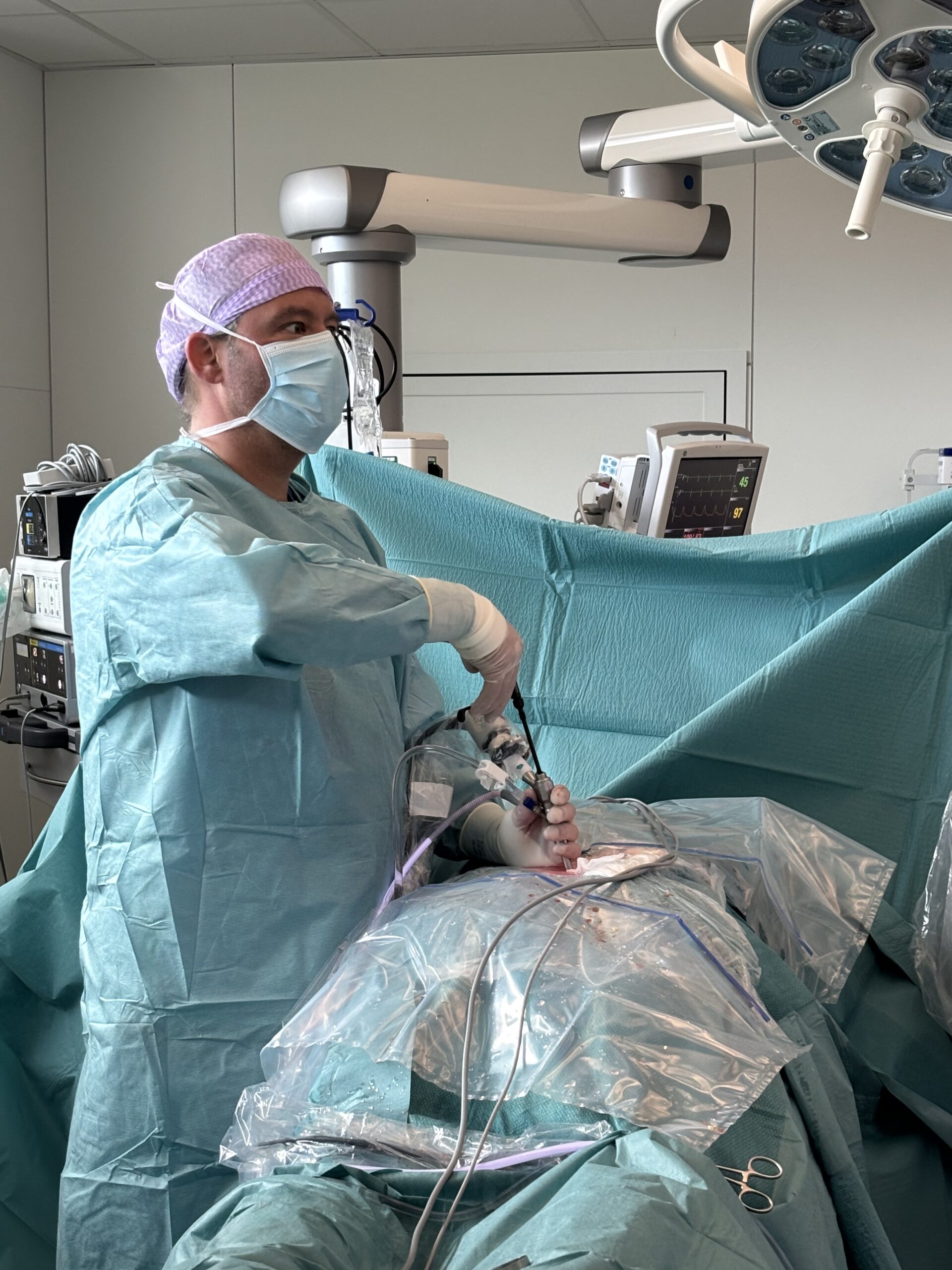PTED hernia verwijderen